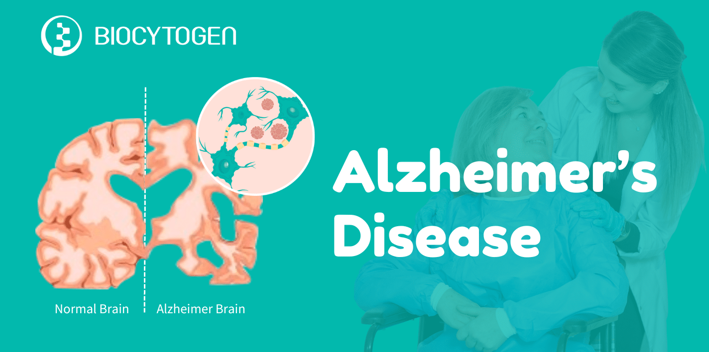 Breaking New Ground in Alzheimer's Treatment: A Deep Dive into Lilly's Kisunla&trade; (Donanemab-azbt) FDA Approval