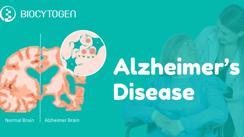 Breaking New Ground in Alzheimer's Treatment: A Deep Dive into Lilly's ...