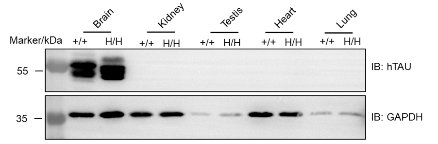 Expression of human TAU protein in homozygous B-hTAU mice
