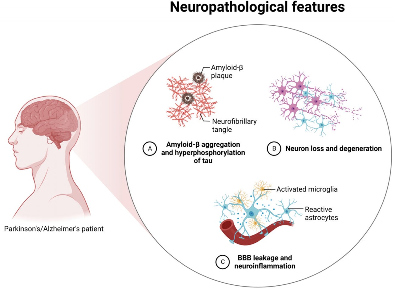 Key pathological drivers of neurodegenerative diseases.