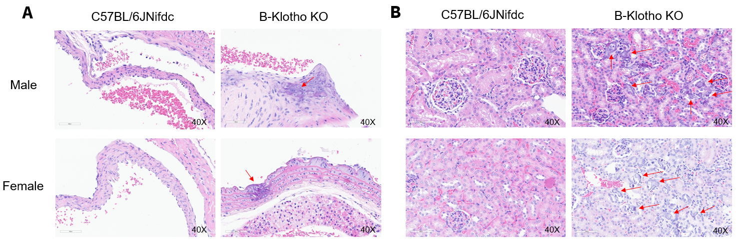B-Klotho KO mice showed accelerated vascular calcification.