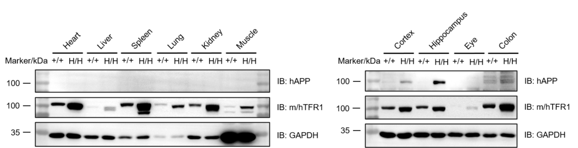 Western blot analysis of APP and TfR1 protein expression in B-hTFR1/B-Tg(5XFAD) mice plus