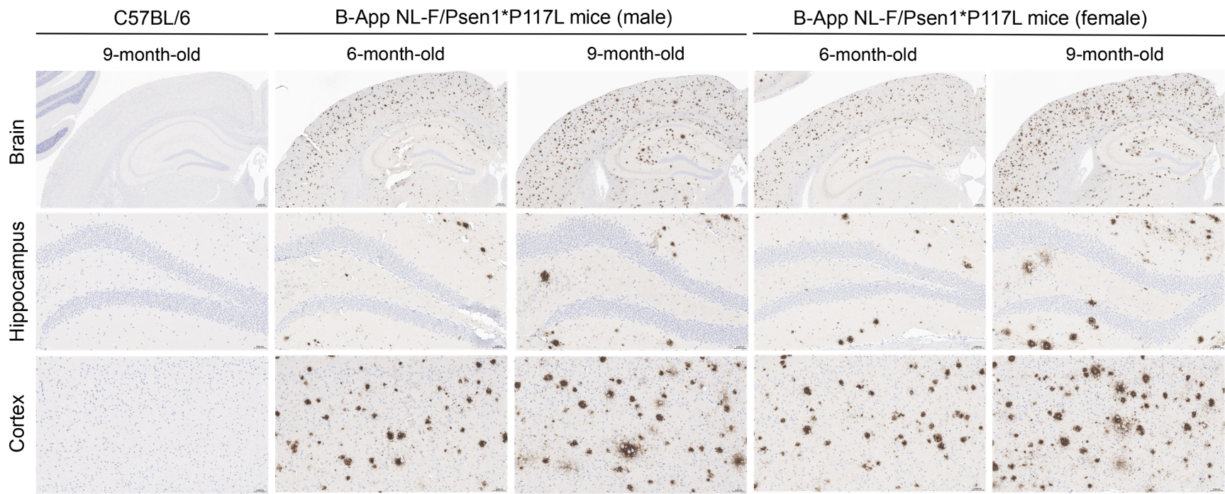 Histopathological analysis of Aβ in homozygous B-App NL-F/Psen1*P117L mice.