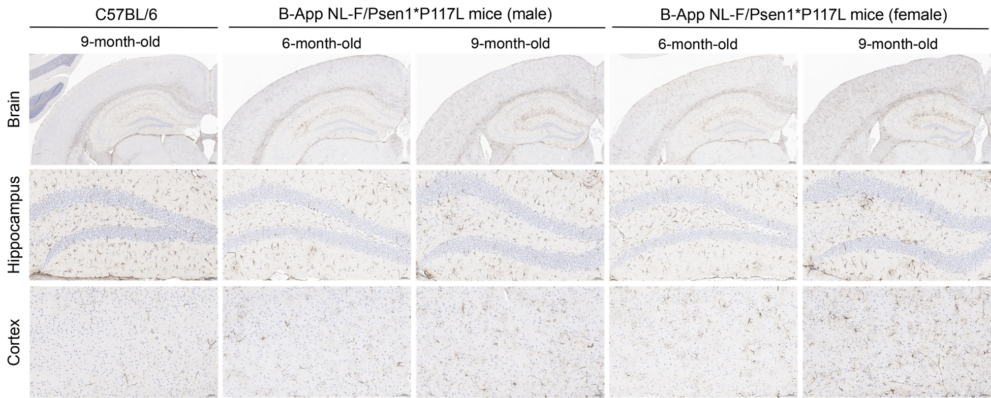 Histopathological analysis of astrocytes in homozygous B-App NL-F/Psen1*P117L mice. 