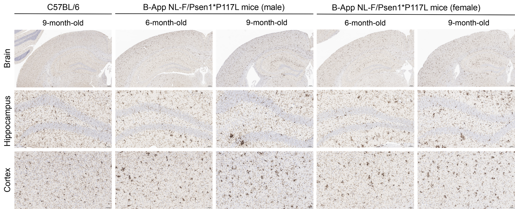 Histopathological analysis of microglia cells in homozygous B-App NL-F/Psen1*P117L mice. 
