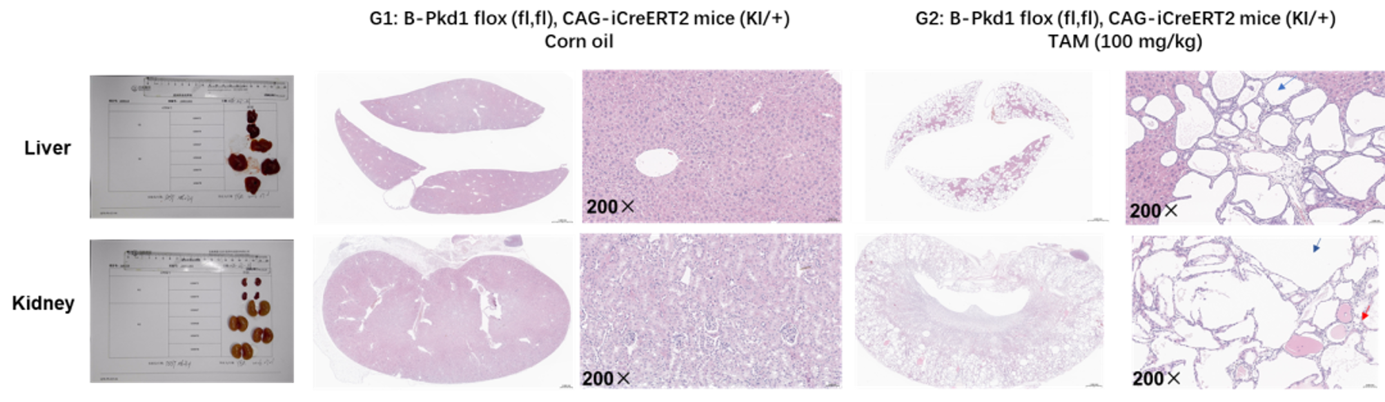 Tamoxifen-induced cystic pathology in B-Pkd1 flox, CAG-iCreERT2 mice. 