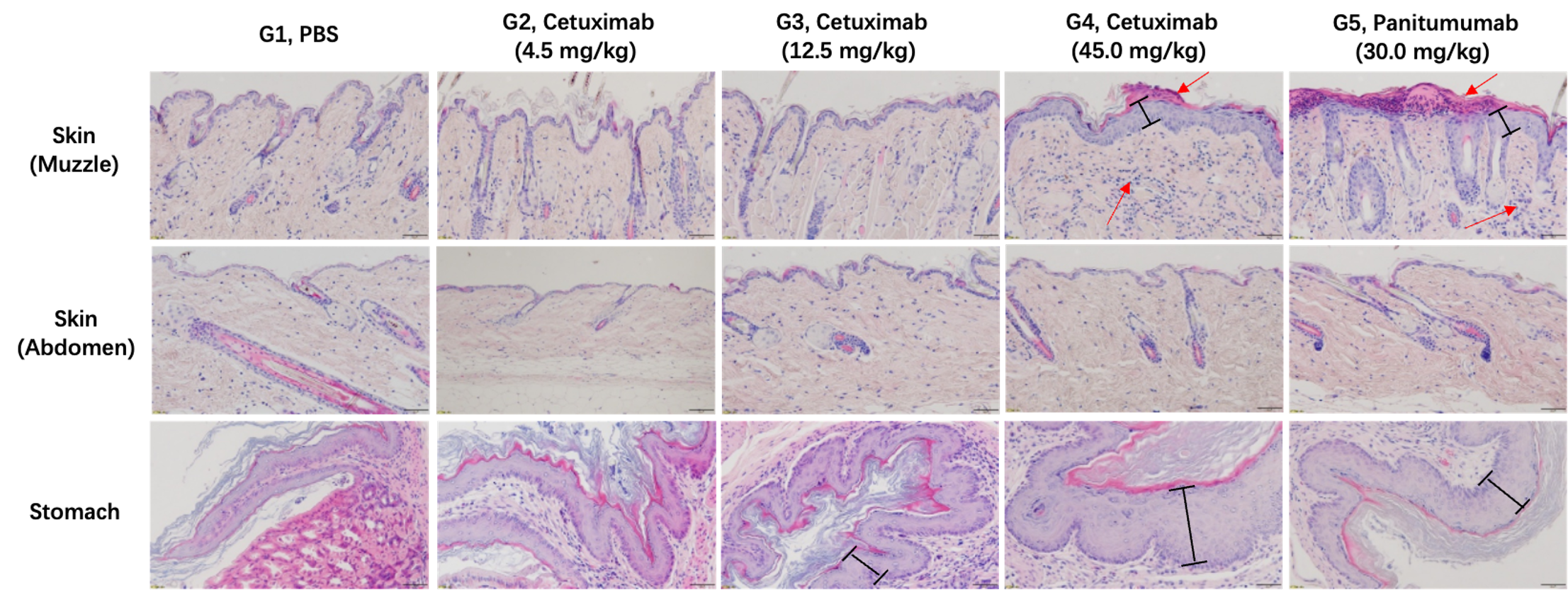 In Vivo Safety Profile of Anti-human EGFR mAbs in B-hEGFR Mice - Histopathology