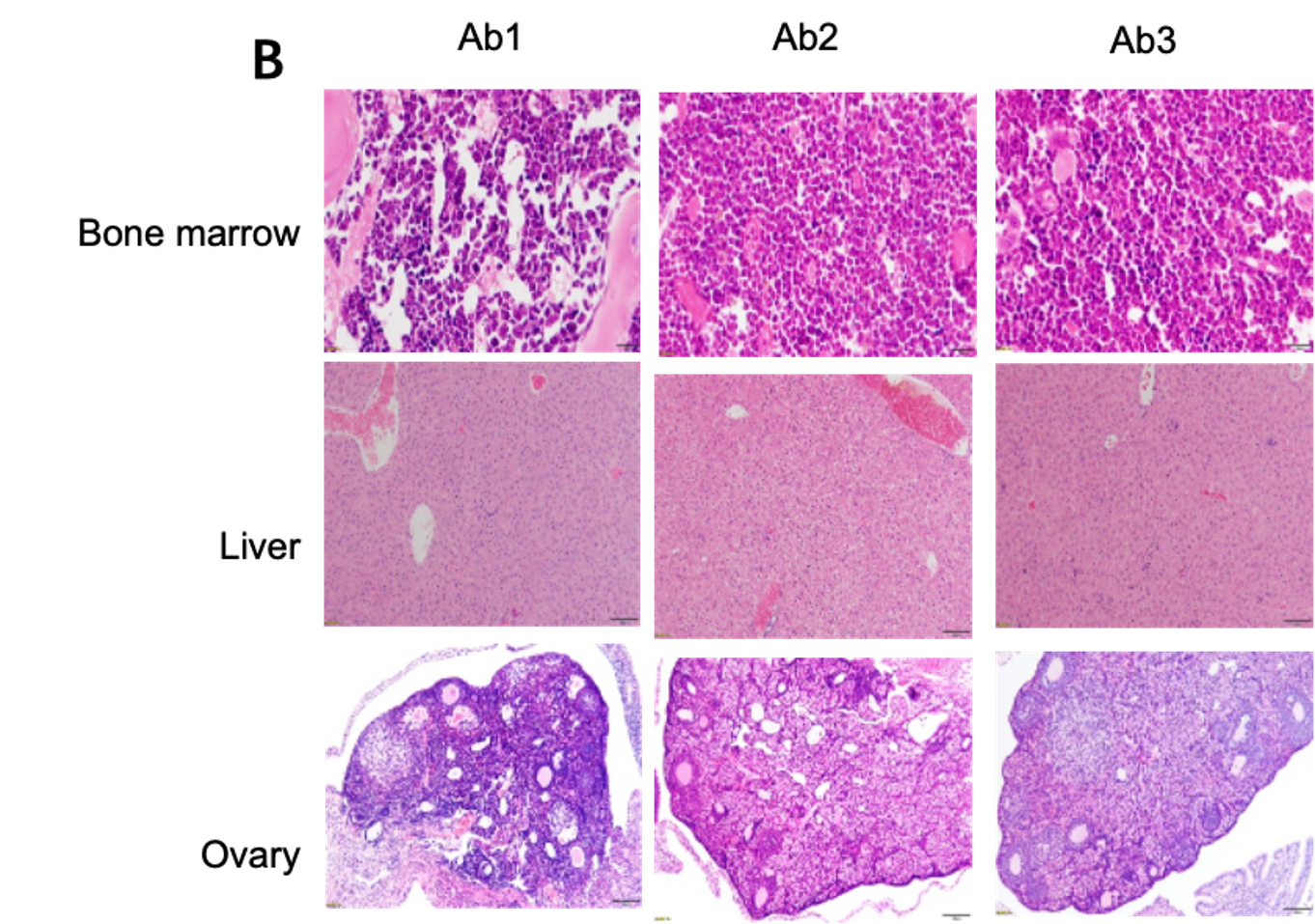 Comparative In Vivo Safety of Anti-human HER2 mAbs in B-hHER2 Mice - Histopathology