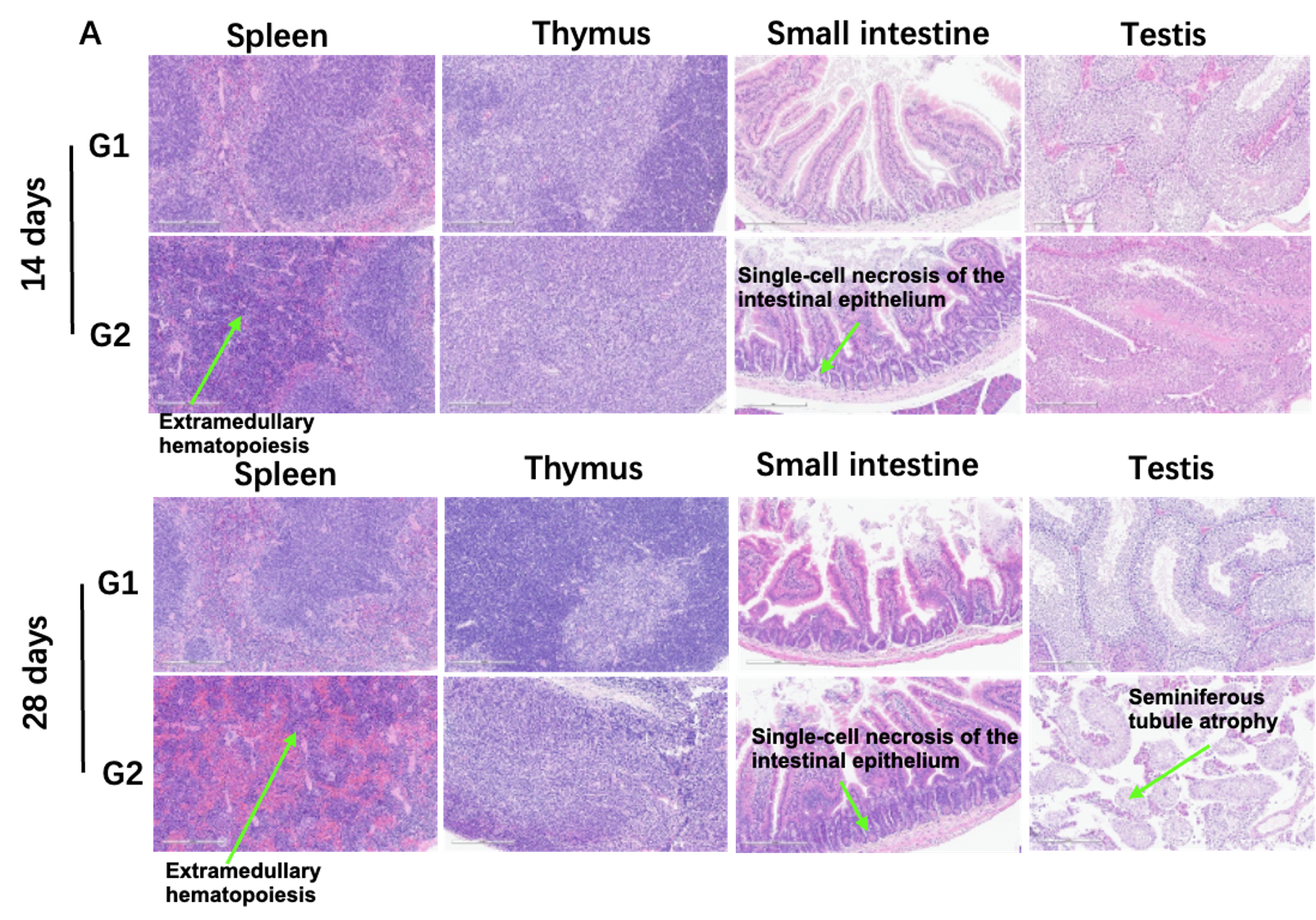 Histopathological Toxicity in B-hHER2 Mice Following DS-8201/ENHERTU Treatment.