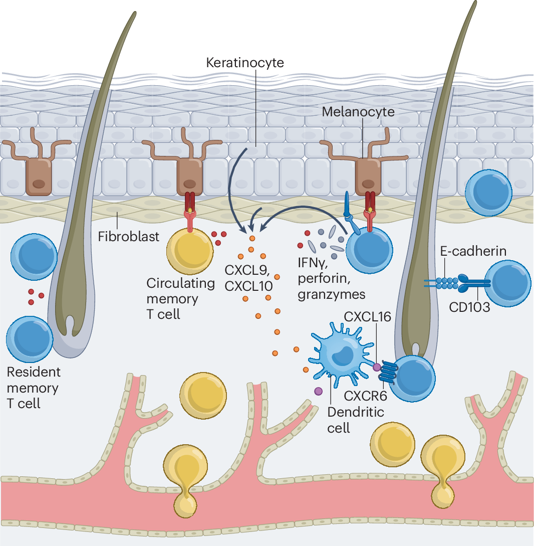 The Immunology of Vitiligo-1