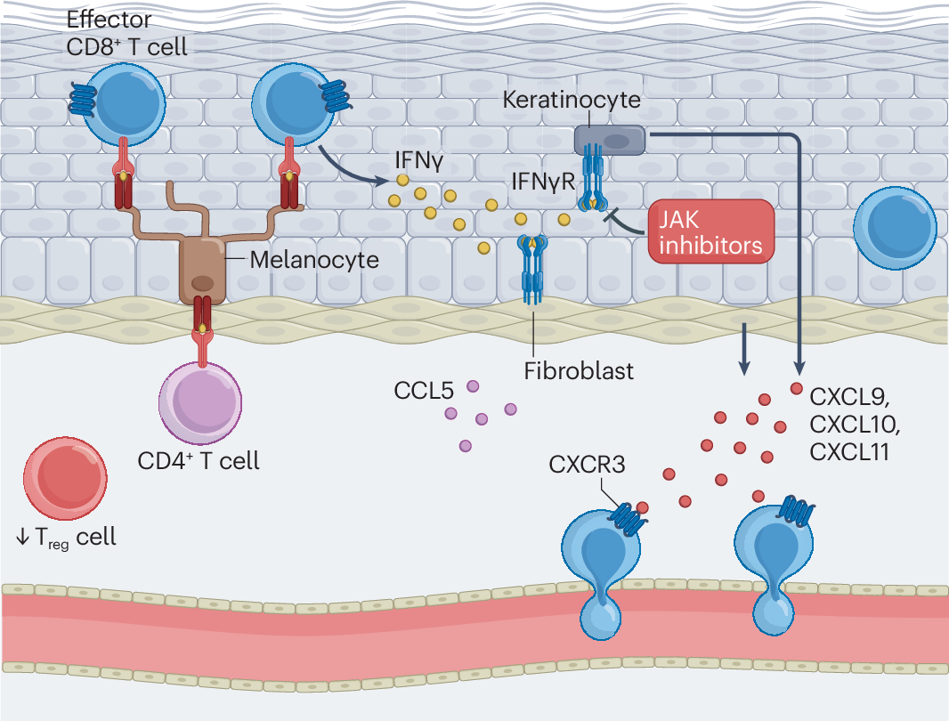 The Immunology of Vitiligo-2