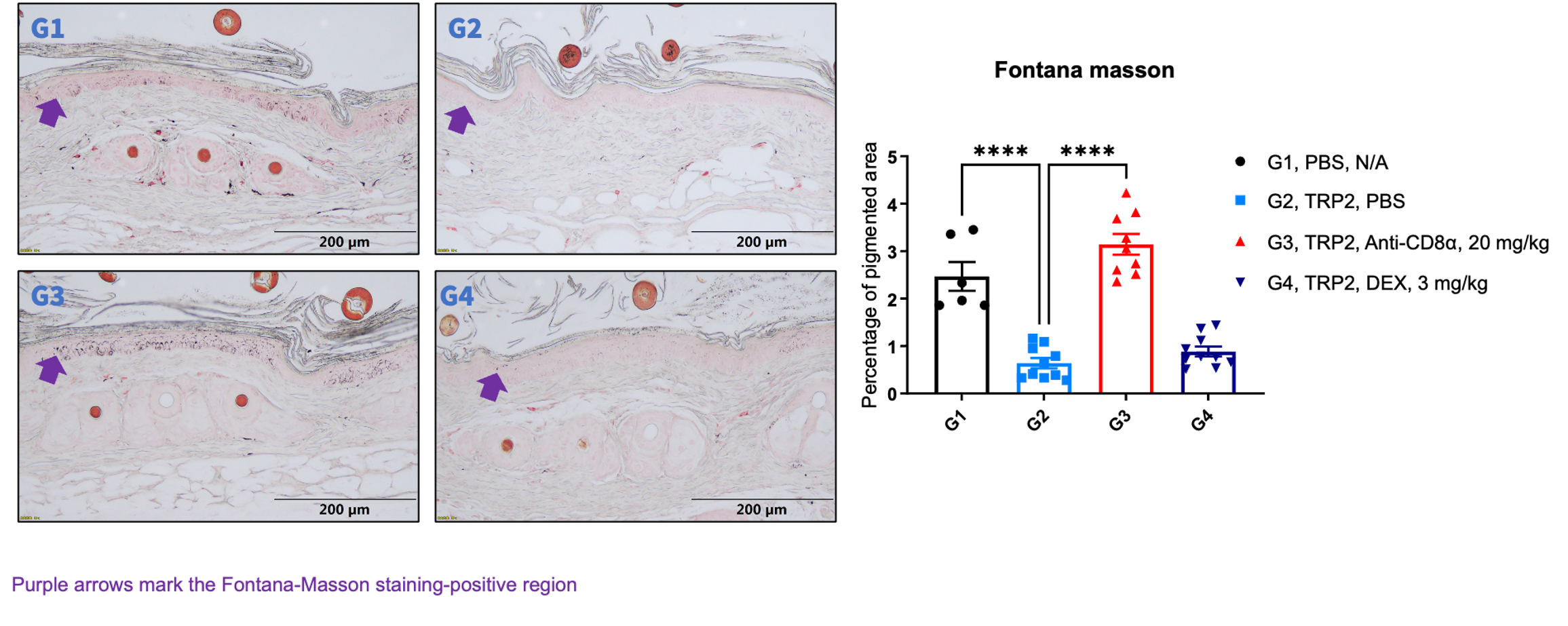 Histopathological Toxicity in B-hHER2 Mice Following DS-8201/ENHERTU Treatment.