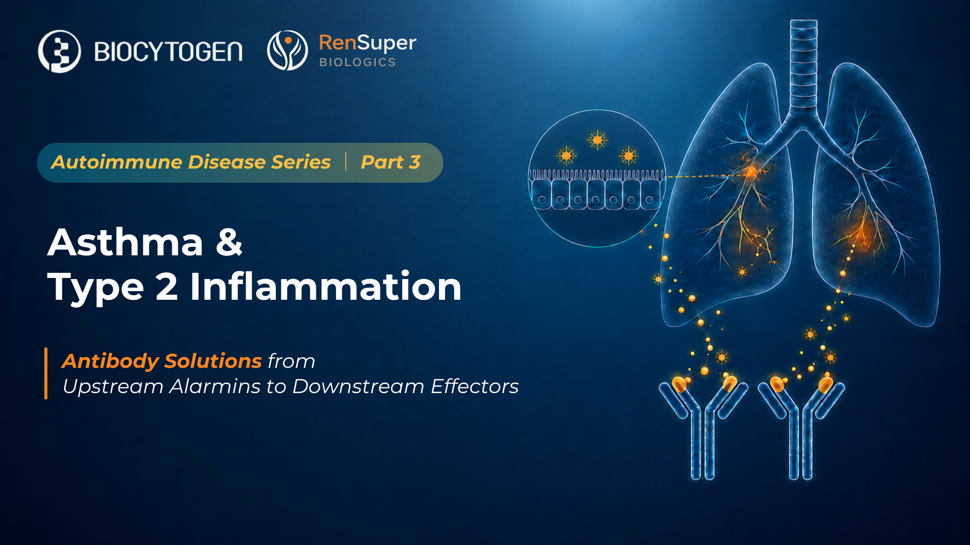 Closing the Loop on Asthma and Type 2 Inflammation: From Upstream Alarmins to Downstream Effectors