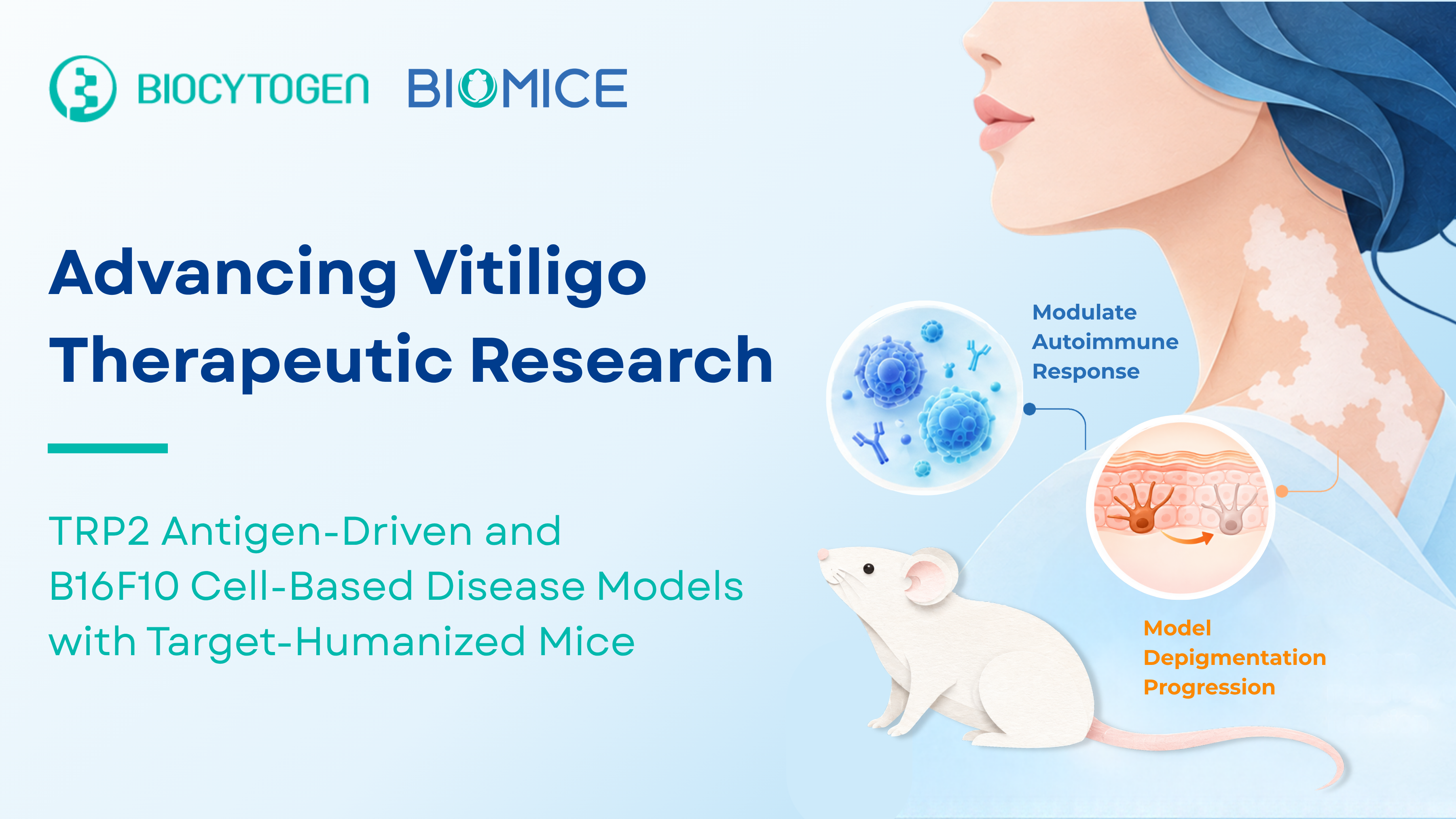 From Immune Mechanisms to Disease Modeling: Advancing Vitiligo Therapeutic Research