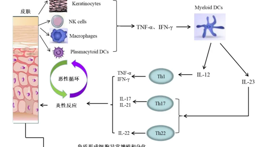 新一代银屑病药物：靶向以IL-17为代表的炎性细胞因子通路