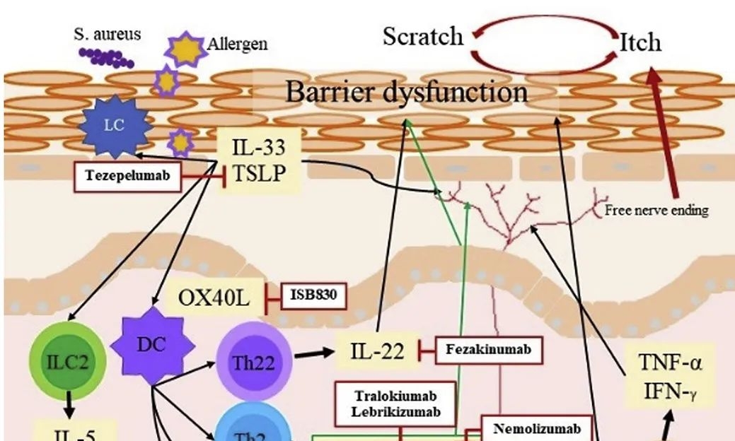 II型炎症皮肤病-特应性皮炎的新靶点