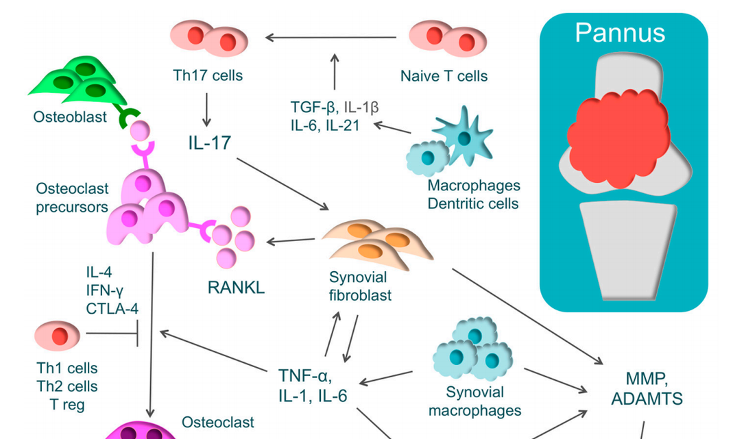 却道天凉好个秋，你的关节还OK吗？