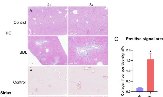 合辑 | 肝脏疾病动物模型，助力药物研发！