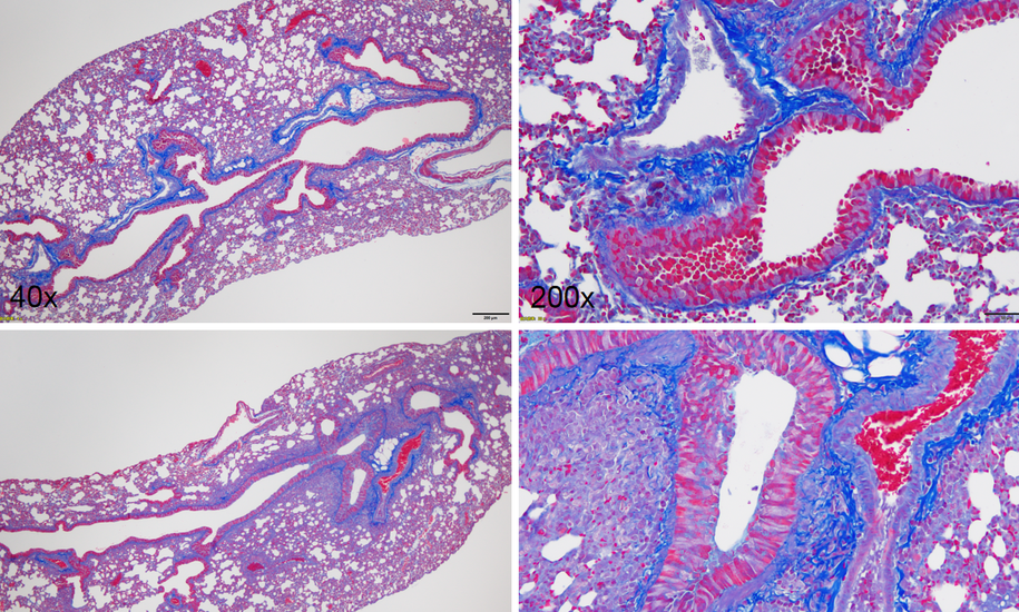 【病理专题】皮肤组织学及银屑病动物模型病理检测