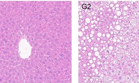 【病理专题】肝脏组织学及 NASH动物模型病理检测