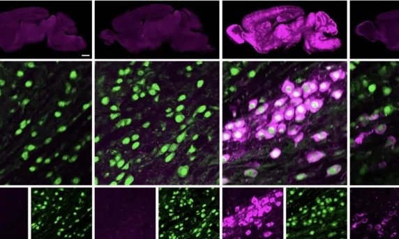 登Science，TFR1有何亮眼之处？