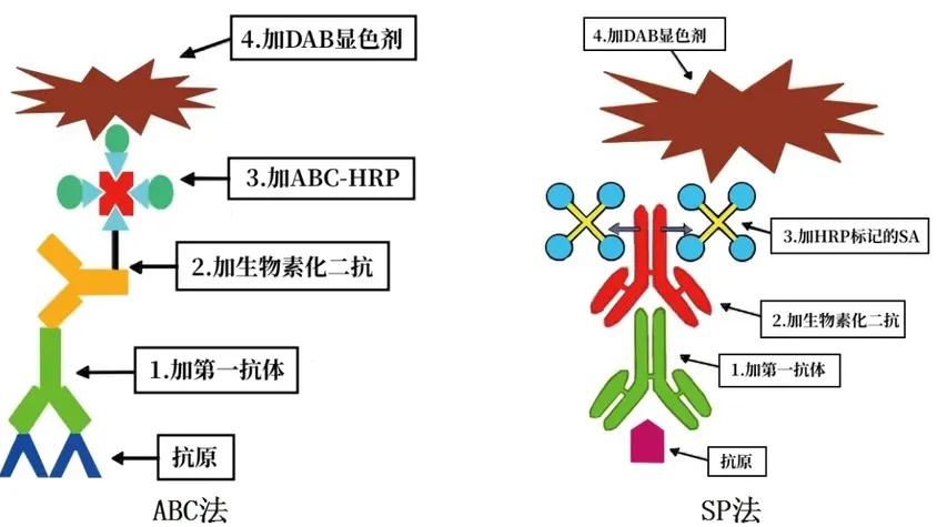 【病理专题】IHC染色技术介绍及一抗选择注意点