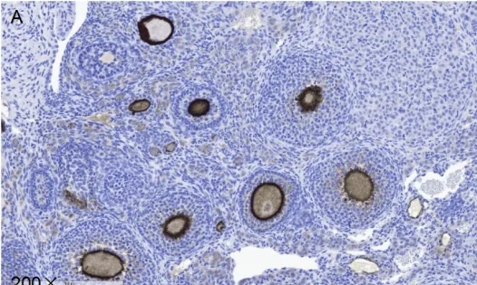 【病理专题】HE及IHC切片质量检查要点分析