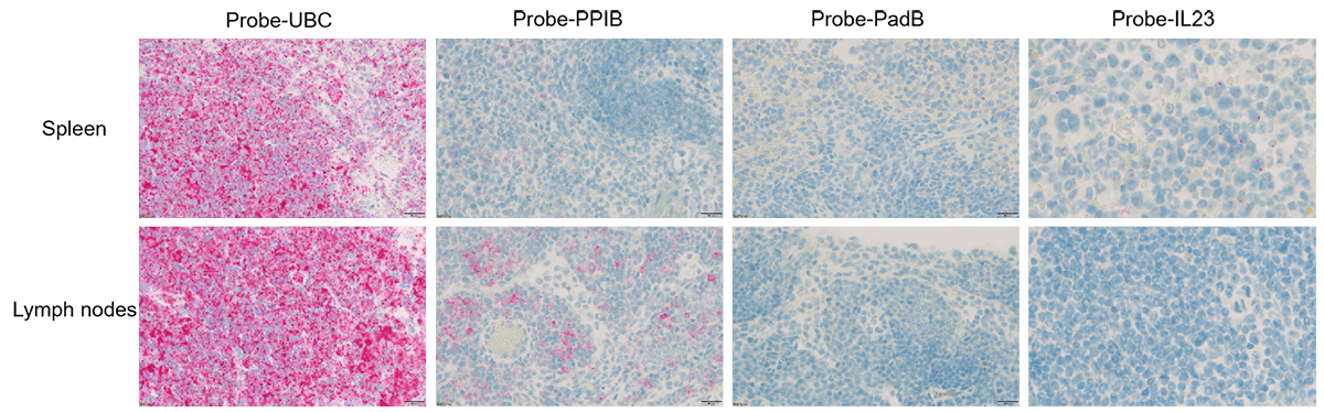 Single-stain detection analysis of RNAscope assay in psoriasis tissues