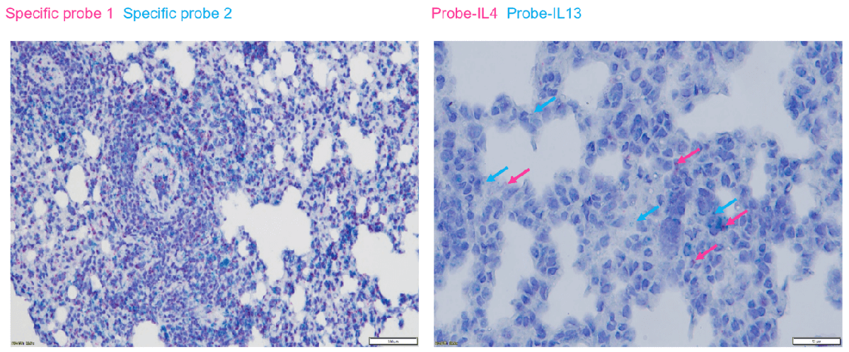 Double-stain detection analysis of RNAscope assay in asthma lung tissues