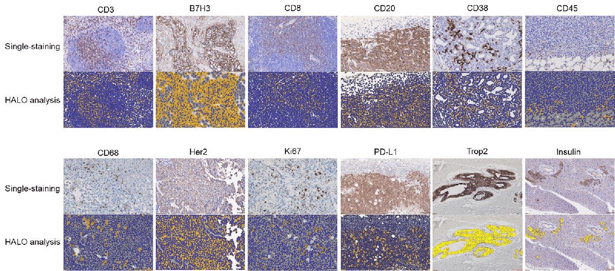 IHC assays-HALO Analysis