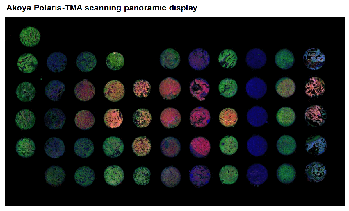 Multiplex IHC-Tyramide Signal Amplification (TSA)