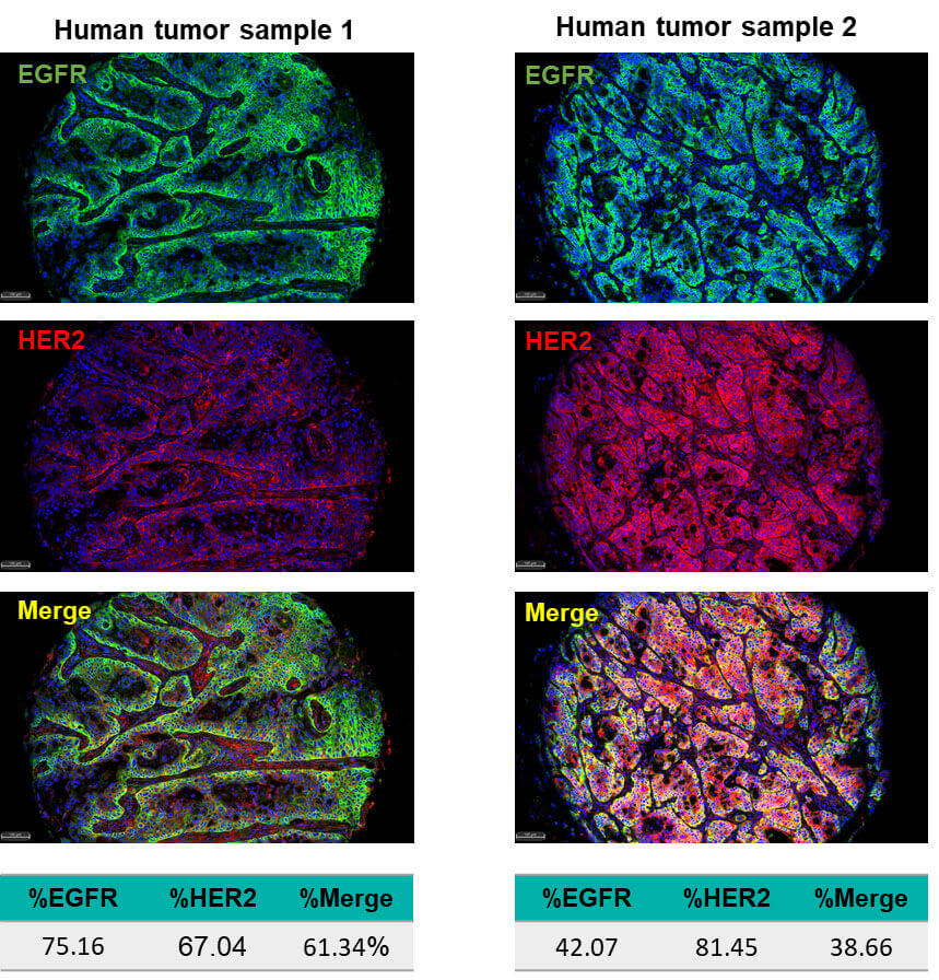 Multiplex IHC-Tyramide Signal Amplification (TSA) 2