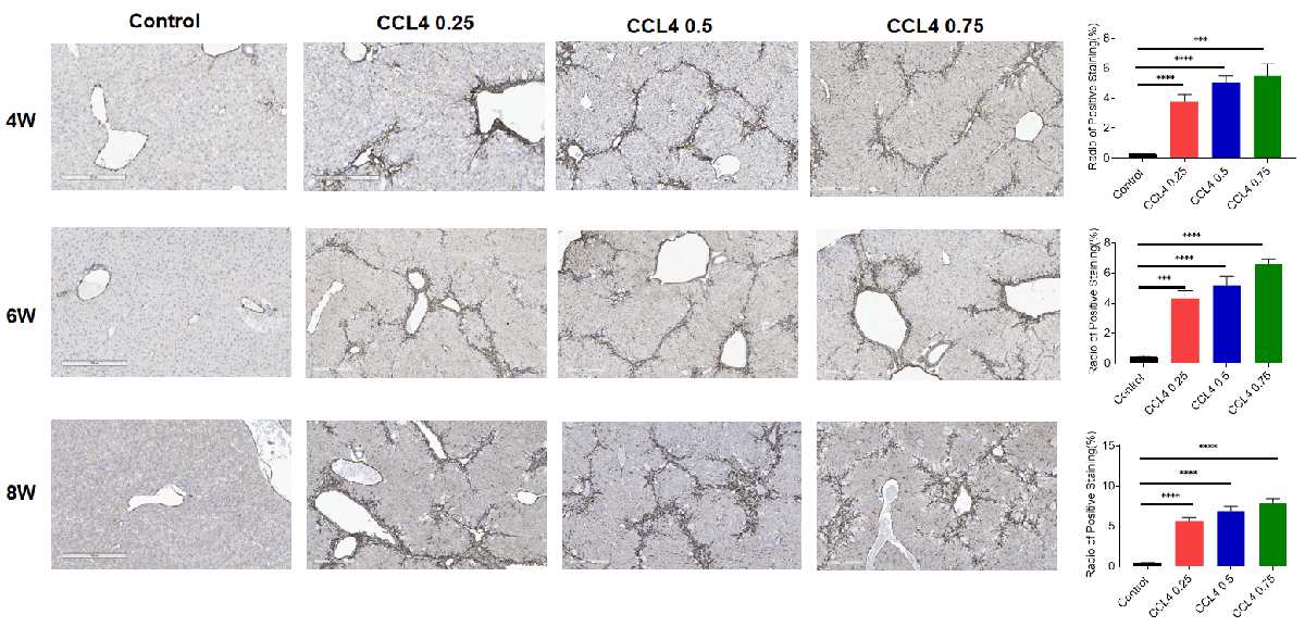 Immunohistochemistry showing fibroblast marker α-SMA in liver