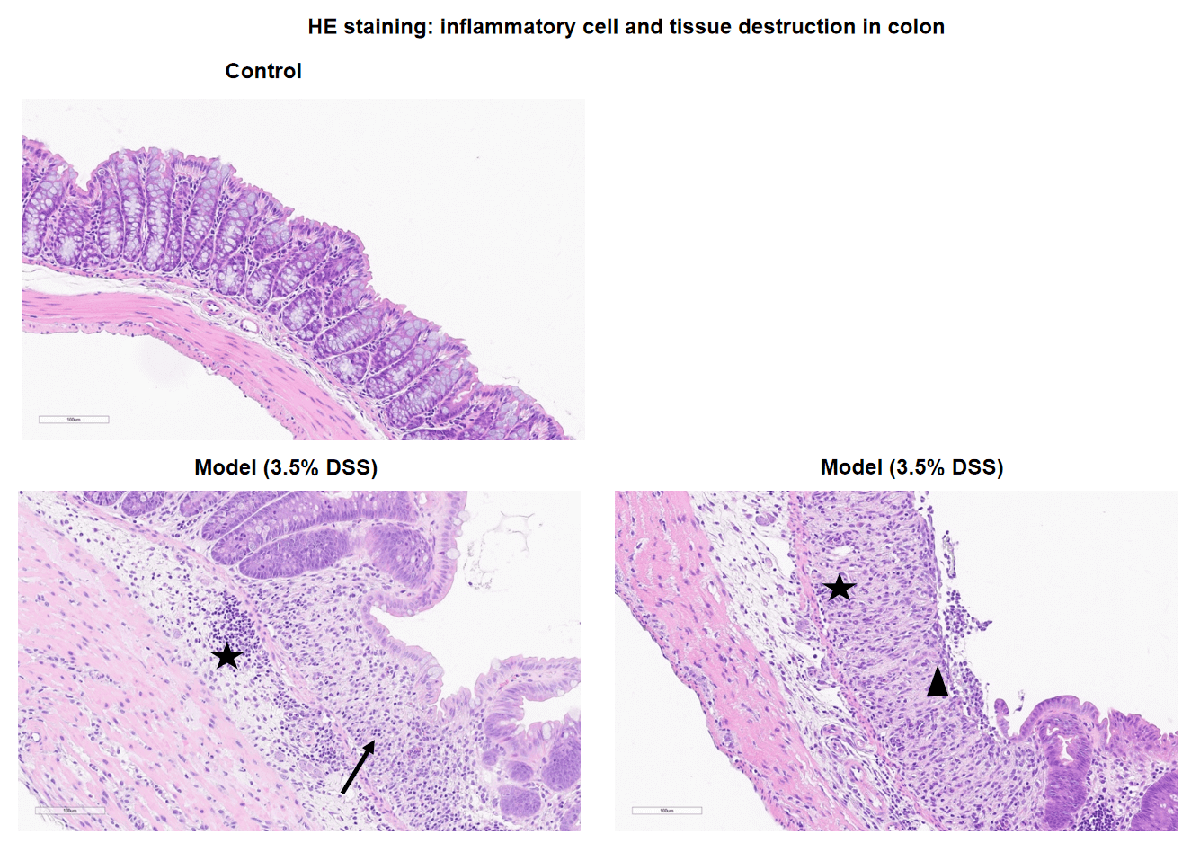 Inflammatory bowel disease (IBD) Mouse Model