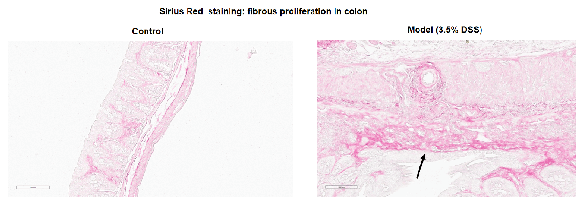 Inflammatory bowel disease (IBD) Mouse Model 2