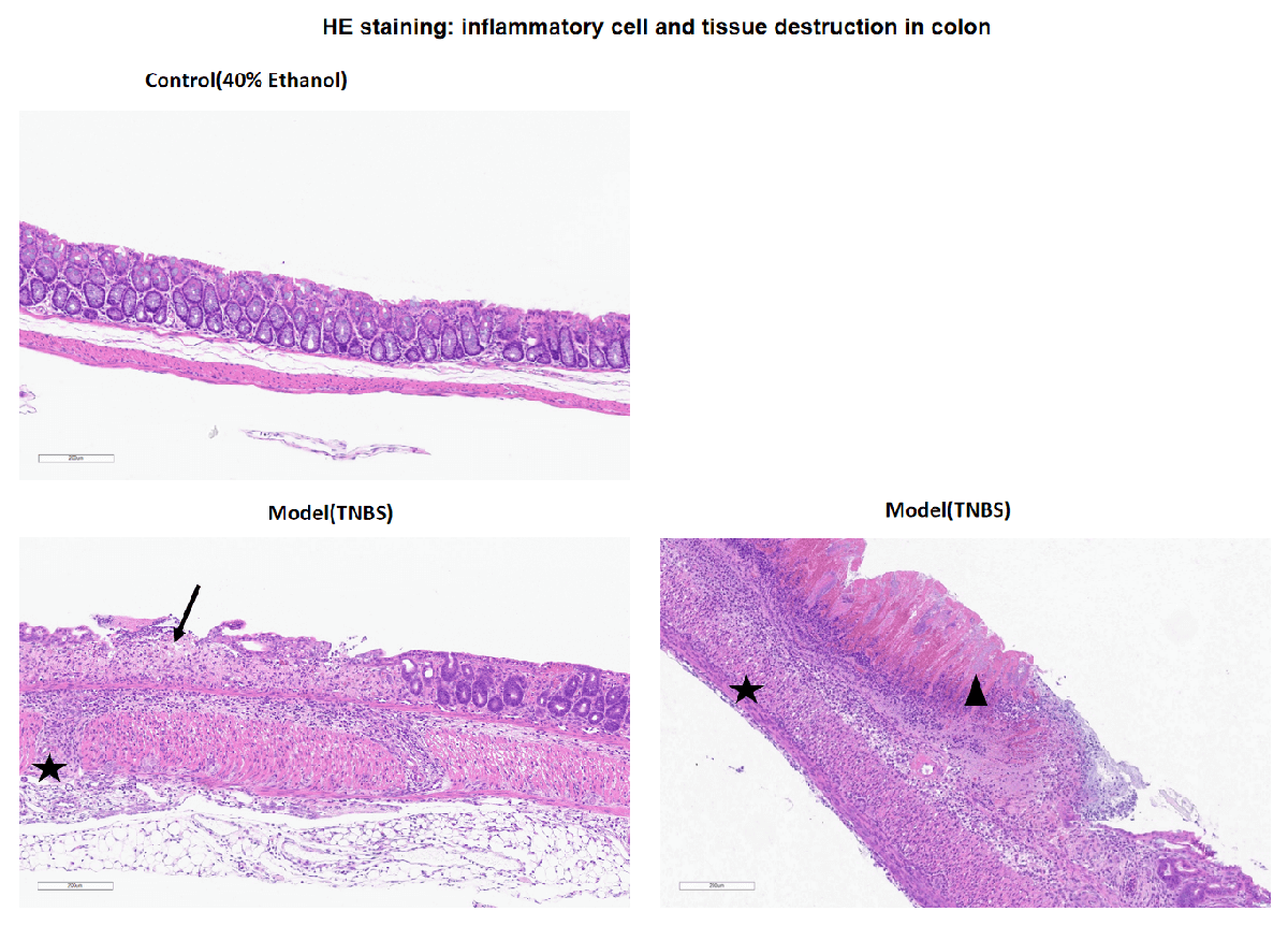 Inflammatory bowel disease (IBD) Mouse Model 3