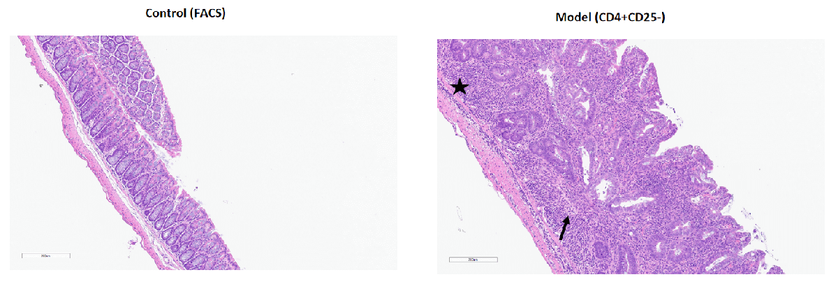 Inflammatory bowel disease (IBD) Mouse Model 4