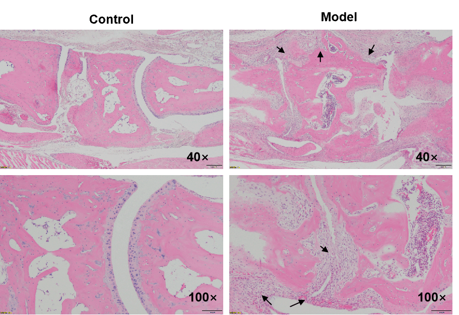Collagen Induced Arthritis (CIA) Mouse Model