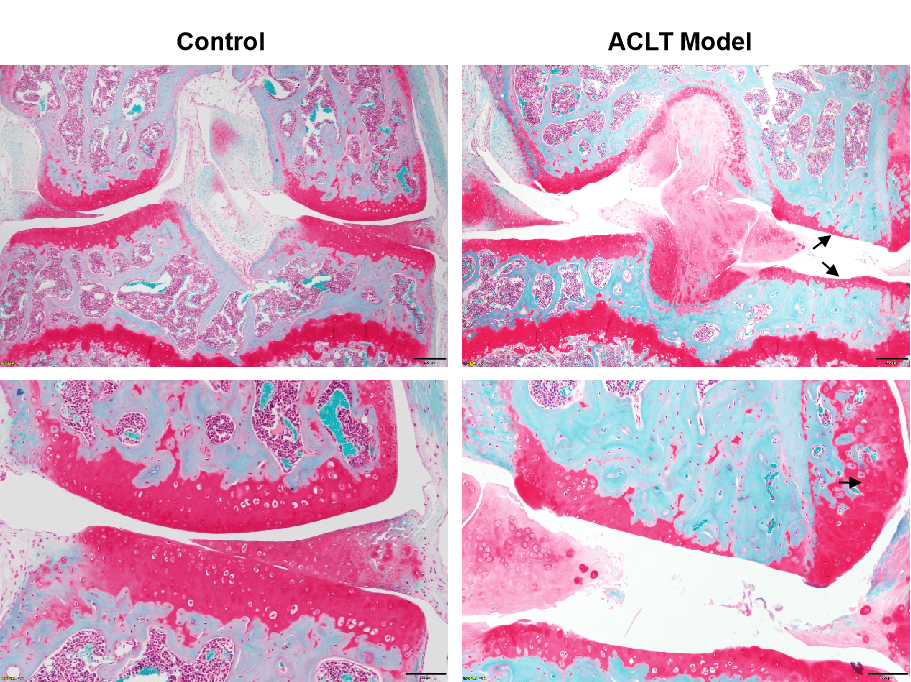 Osteoarthritis (OA) Mouse Model