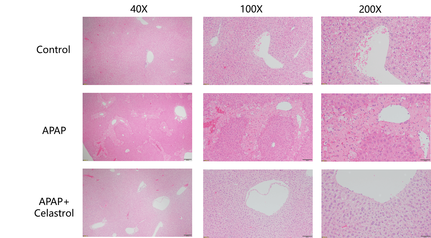 Protective effects of Celastrol in APAP model