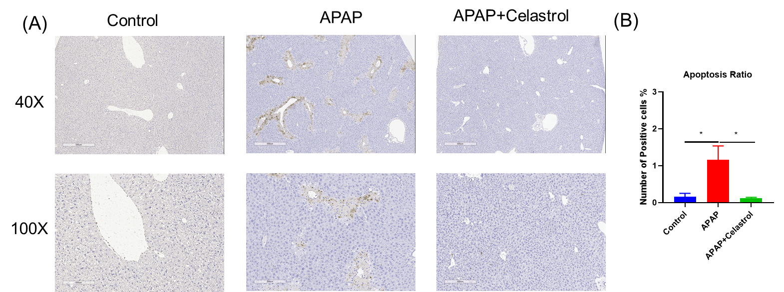 Celastrol reduced apoptosis in APAP Model