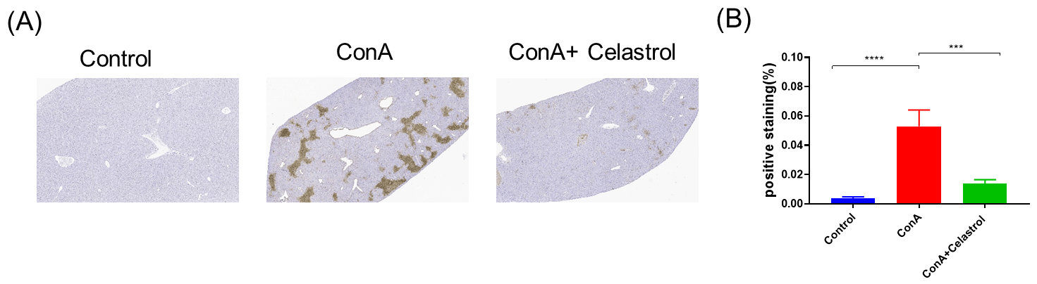 ConA model establishment and in vivo efficacy of Celastrol in ConA Model 2