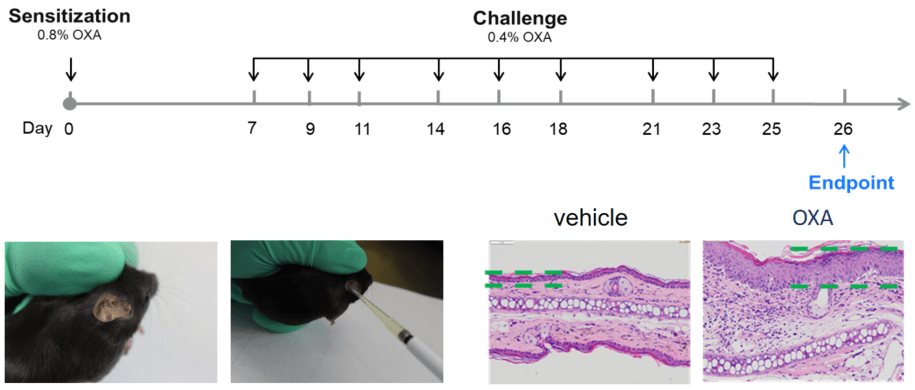 Establishment of OXA induced Atopic Dermatitis Mouse Model