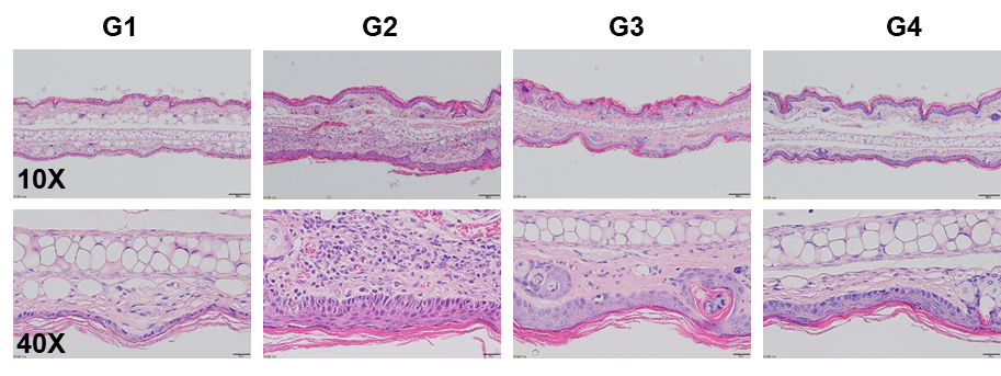 Efficacy Evaluation of Dexamethasone and Crisaborole (PDE-4 inhibitor) in MC903-Induced Atopic Dermatitis Mouse Model in BALB/c Mice 3