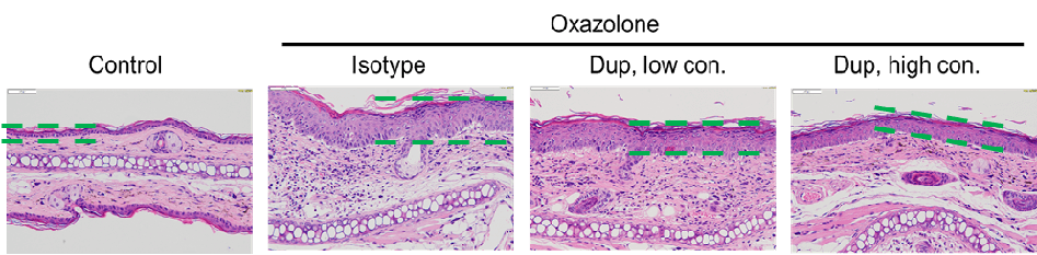 Efficacy Evaluation of Dupilumab in OXA-Induced Atopic Dermatitis Mouse Model of IL4/IL4RA Humanized mice (B-hIL4/hIL4RA mice) 2
