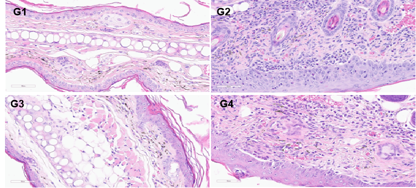 Efficacy Evaluation of Anti-Human TSLP in OXA-Induced Atopic Dermatitis Mouse Model of TSLP/TSLPR Humanized mice (B-hTSLP/hTSLPR mice) 3
