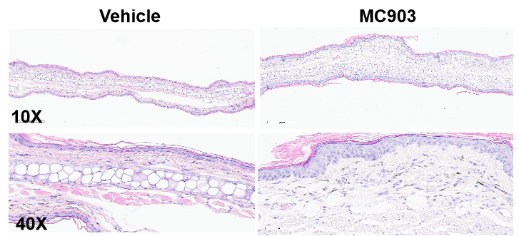 Establishment of MC903-Induced Atopic Dermatitis Mouse Model of C57BL/6 Mice 2