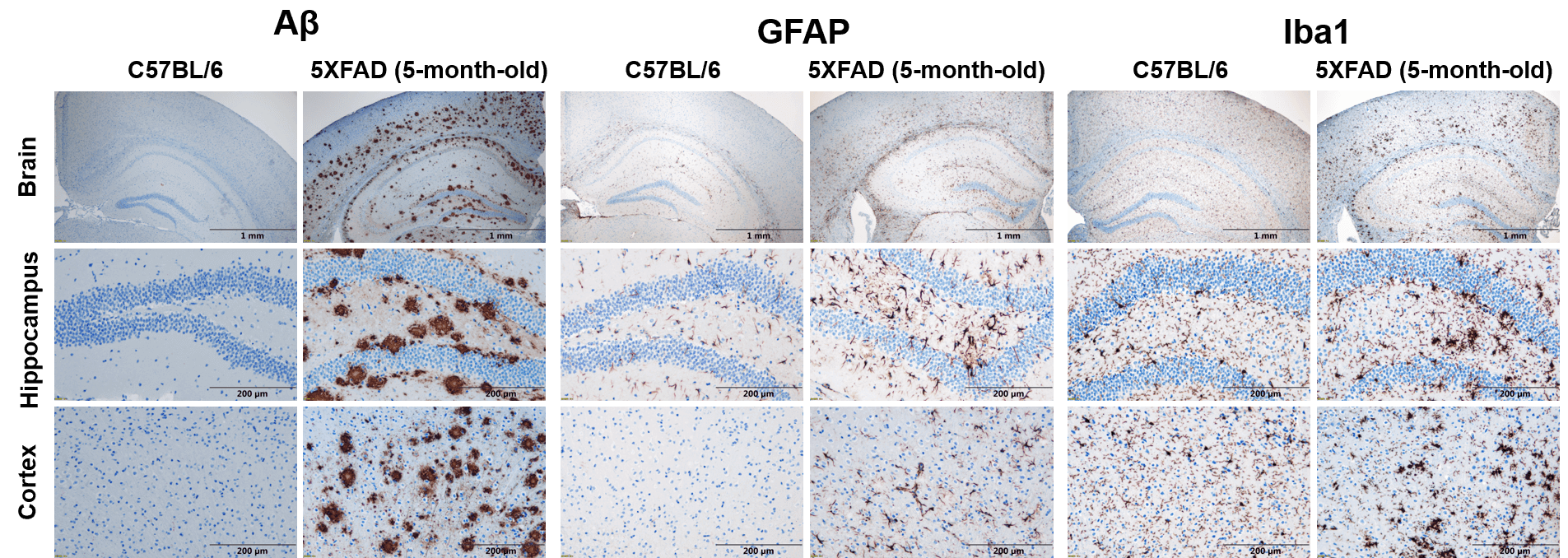 Histopathological analysis of brain in Tg(5XFAD) mice