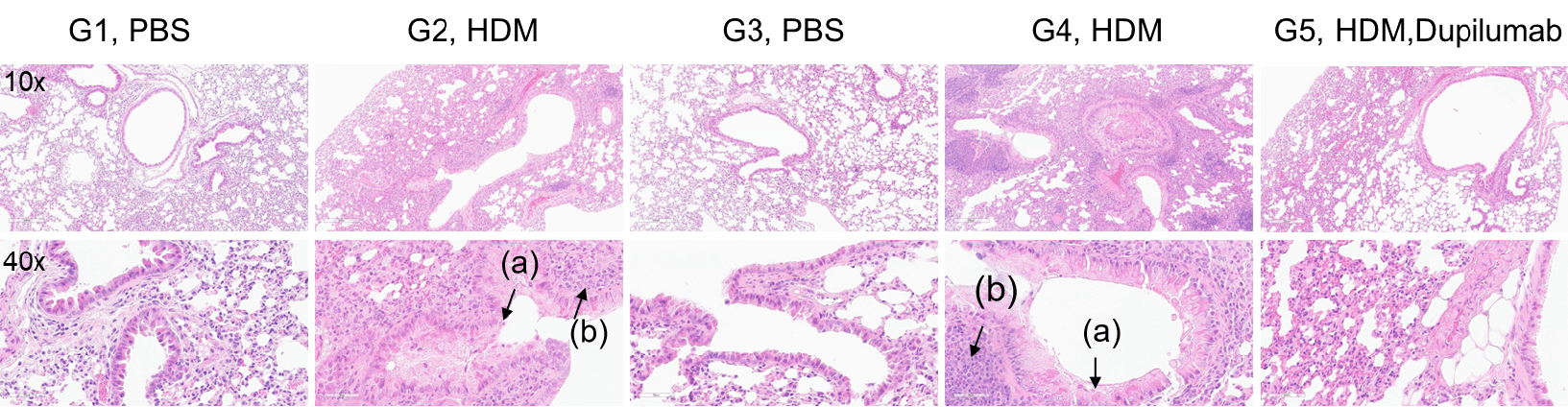 Efficacy Evaluation of the anti-human IL4R (Dupilumab) in HDM-induced Asthma Model of IL4 and IL4 Receptor Humanized Mice 2