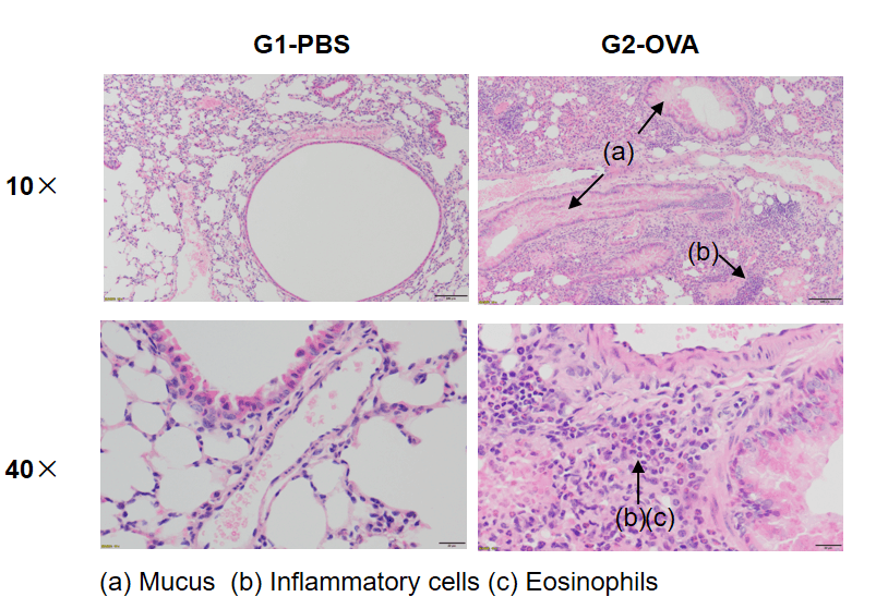 Airway Histology in Asthmatic Mouse Model